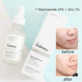 Buy The Ordinary Niacinamide 10% + Zinc 1%, 30ml- in Pakistan