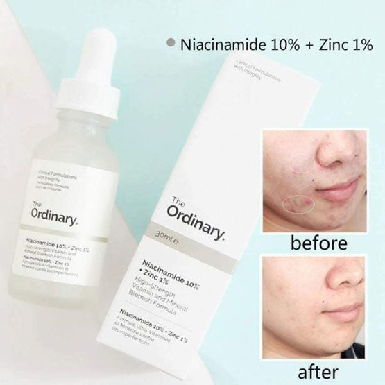 Buy The Ordinary Niacinamide 10% + Zinc 1%, 30ml- in Pakistan