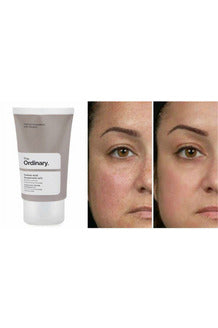 Buy The Ordinary Azelaic Acid Suspension 10%, 30ml- in Pakistan