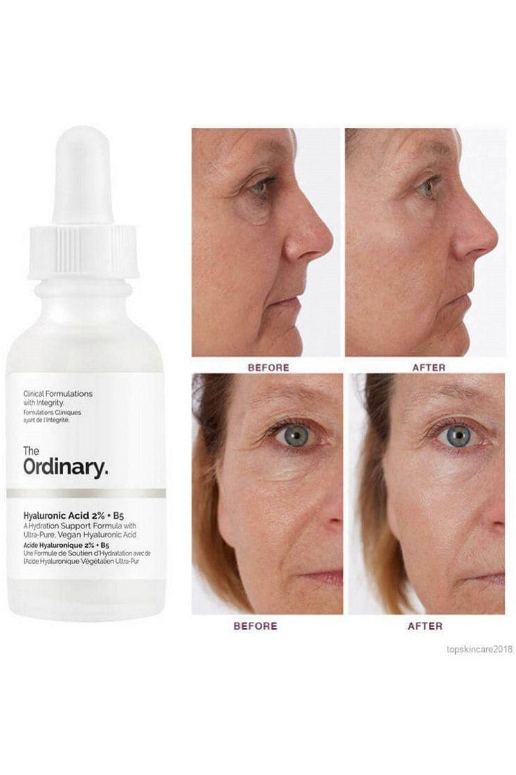 Buy The Ordinary Hyaluronic Acid 2% + B5, 30ml- in Pakistan