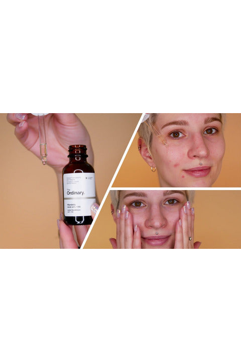 Buy The Ordinary Mandelic Acid 10% HA, 30 ml- in Pakistan