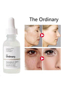 Buy The Ordinary Niacinamide 10% + Zinc 1%, 30ml- in Pakistan