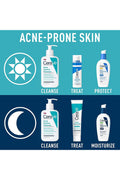 Buy CeraVe Acne Control Gel 2% Salicylic Acid Acne Treatment - 40ml in Pakistan